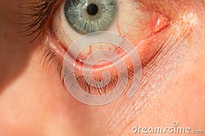 The manâ€™s eye is gray-blue with red veins on it very close Stock Photo